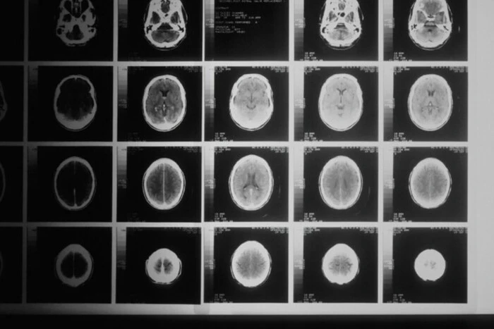 Sztuczna inteligencja od Microsoftu przewyższa lekarzy w diagnostyce skomplikowanych chorób